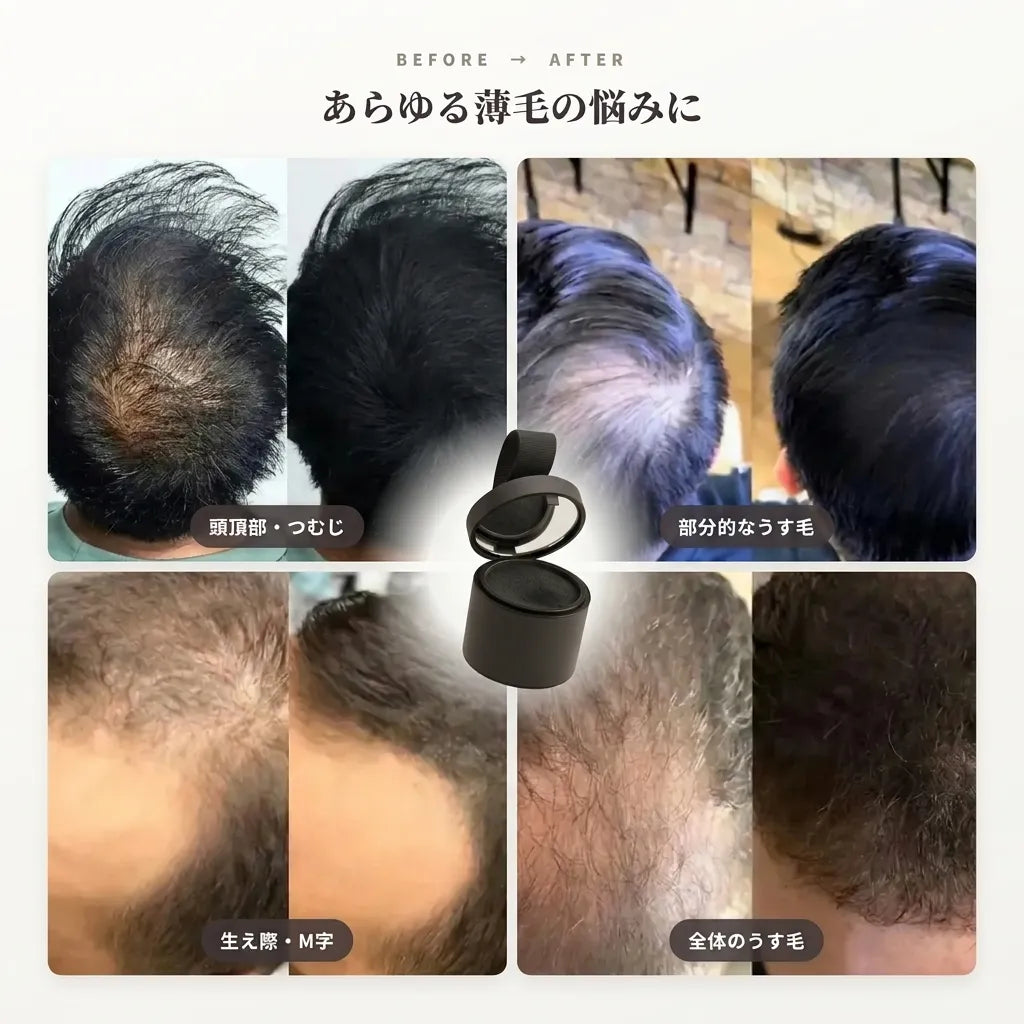 【10秒でふんわり自然カバー】Shitsuke ヘアラインパウダー｜薄毛隠し・生え際・分け目・白髪